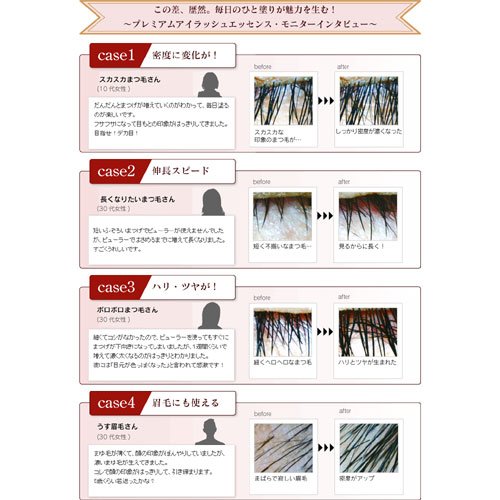 アールスタイル まつげ美容液でまつ毛育毛!プ