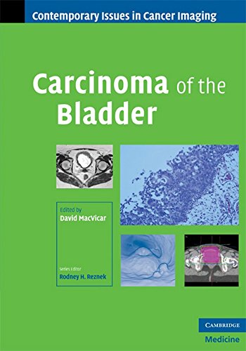 Carcinoma of the Bladder (Contemporary Issues in Cancer Imaging)