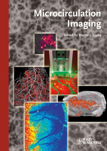 Microcirculation Imaging