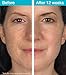 MD Complete Dark Spot Corrector Anti-Aging by Dr. Brian Zelickson 1.7 fl oz (50mL)