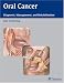 Oral Cancer: Diagnosis, Management, and Rehabilitation