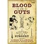Blood and Guts: A History of Surgery