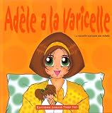 Adele a la varicelle