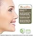 Soniworks Replacement Facial Cleansing Brush Heads(2-Pack),Designed for Acne-Prone Skin Cleansing, Fits Mia,Mia2,Mia3(Aria),SMART Profile,Alpha Fit,Pro,Plus,and Radiance Cleansing Systems