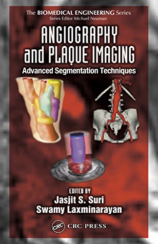 Angiography and Plaque Imaging: Advanced Segmentation Techniques (Biomedical Engineering)