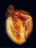 Human Heart Angiogram Mouse Pad