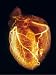 Human Heart Angiogram Mouse Pad