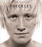 Freckles