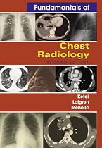 Fundamentals of Chest Radiology (Fundamentals of Radiology)