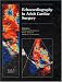 Books : Echocardiography in Adult Cardiac Surgery