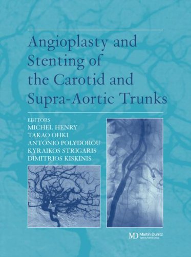 Aortic-Stenosis