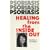 Psoriasis, Healing from the Inside Out