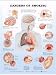 Dangers of Smoking Anatomical Chart