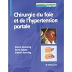Chirurgie du