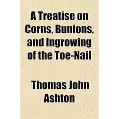 A Treatise on Corns, Bunions, and Ingrowing of the Toenail; Their Cause and Treatment by Thomas John Ashton