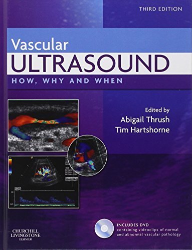 By Abigail Thrush BSc(Physics) MSc(Medical Physics) MIPEM (member of the Institute of Physics and Engineering in Medicine), Timothy Hartshorne HND in Biology: Vascular Ultrasound: How, Why and When, 3e Third (3rd) Edition (With CD)