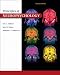 Principles of Neuropsychology