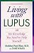 Living With Lupus: All the Knowledge You Need to Help Yourself