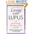 Living With Lupus: All The Knowledge You Need To Help Yourself