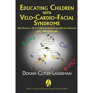 Cardio Facial Syndrome