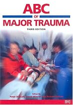 ABC of Major Trauma (ABC Series)