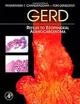 GERD: Reflux to Esophageal Adenocarcinoma