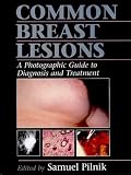 Common Breast Lesions: A Photographic Guide to Diagnosis and Treatment
