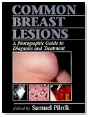 Common Breast Lesions: A Photographic Guide to Diagnosis and Treatment