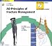 AO Principles of Fracture Management