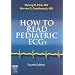 How to Read Pediatric ECGs, 4e