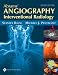 Abrams' Angiography: Interventional Radiology