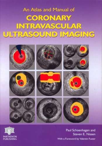 City Travel Guides Discounted  Used : An Atlas and Manual of Coronary Intravascular Ultrasound Imaging