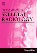 Fundamentals of Skeletal Radiology (Fundamentals of Radiology)