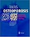 Book OSTEOPOROSIS: Diagnosis, Prevention, Therapy