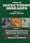 Atlas of Infectious Diseases: Pleuropulmonary and Bronchial Infections, Volume 6, 1e (Vol 6)