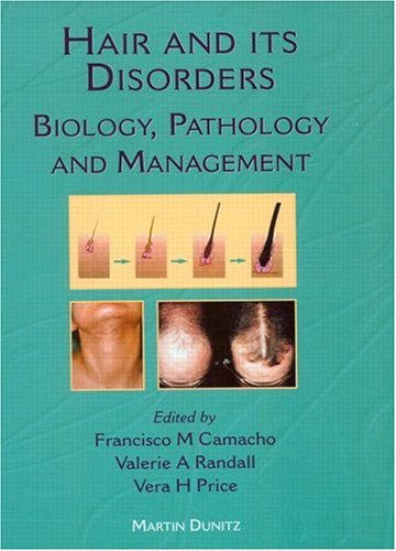Hair and its Disorders: Biology, Pathology and Management