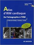 Atlas d'imagerie cardiaque : De l'�chographie � l'IRM