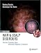 Hair and Scalp Disorders