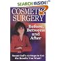 Cosmetic Surgery: Before, Between and After