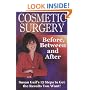 Cosmetic Surgery: Before, Between and After