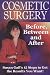 Cosmetic Surgery: Before, Between and After
