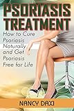 Psoriasis Treatment: How to Cure Psoriasis Naturally And Get Psoriasis-Free For Life (Psoriasis, Psoriasis free for life, Psoriasis Cure, Psoriasis Di