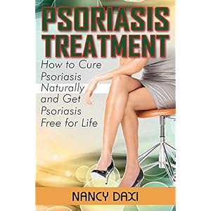 Psoriasis Treatment: How to Cure Psoriasis Naturally And Get Psoriasis-Free For Life (Psoriasis, Psoriasis free for life, Psoriasis Cure, Psoriasis Di