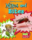 Mites and bites