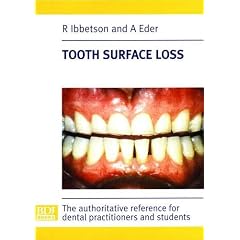 Tooth Surface Loss