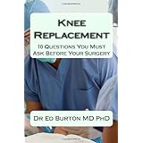 knee replacement 10 questions you must ask before your surgery