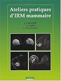 Ateliers Pratiques d'IRM Mammaire