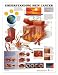 Understanding Skin Cancer Anatomical Chart Paper Unmounted