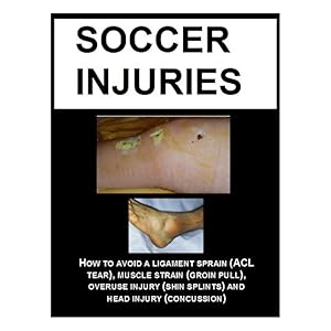 sprained acl