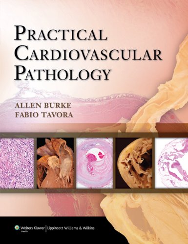 Practical Cardiovascular Pathology, by Allen P. Burke, Fabio Tavora